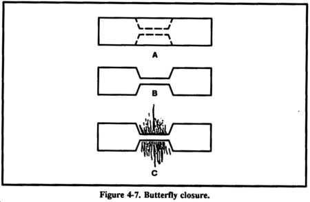 Figure 4-7. Butterfly closure